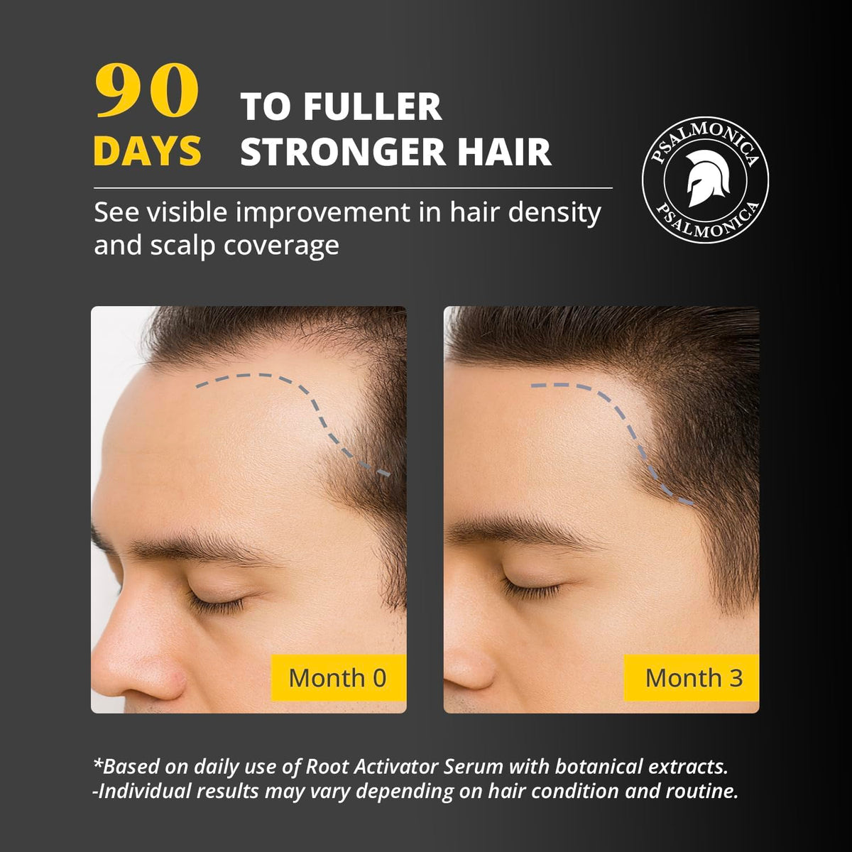 Psalmonica scalp massage action highlighting easy application.