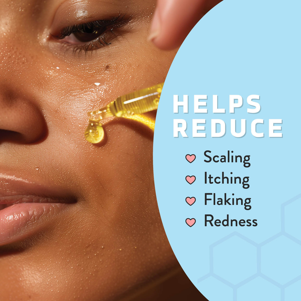 Psoriasis Honey Nourishing Scalp Serum dropper enables easy, fast absorption on contact