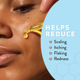 Psoriasis Honey Nourishing Scalp Serum dropper enables easy, fast absorption on contact