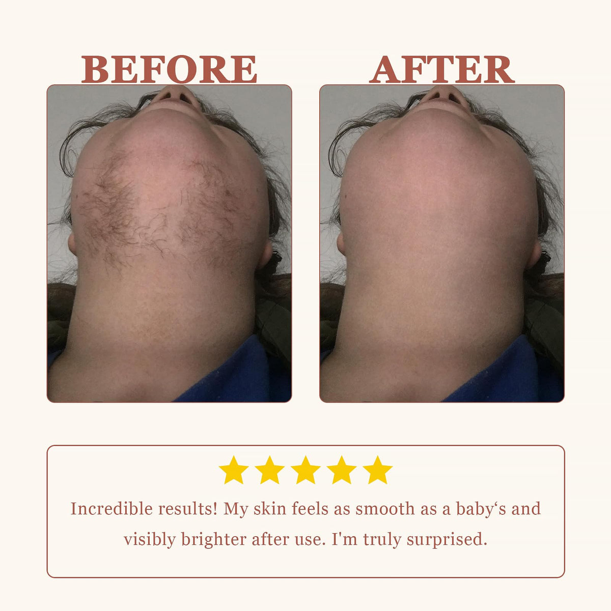 PUILOG post-care soothing cream tube improving skin comfort after use