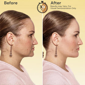 Pure Kind 5-pack box showing convenient at-home neck care routine.