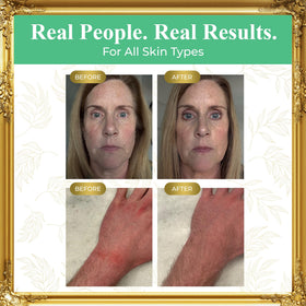 Pure Truth unscented balm on face demonstrates gentle hydration