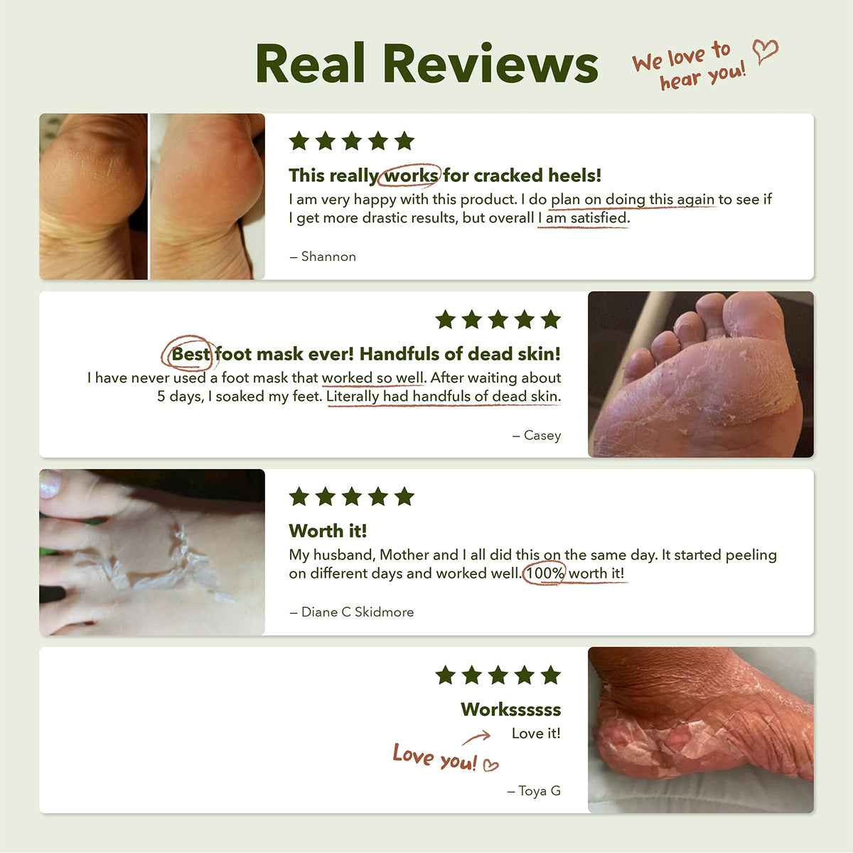 Purederm mask fits men and women for most foot sizes.