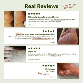 Purederm mask fits men and women for most foot sizes.