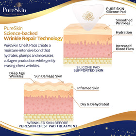 PureSkin heart-shaped adhesive shows secure overnight hold.