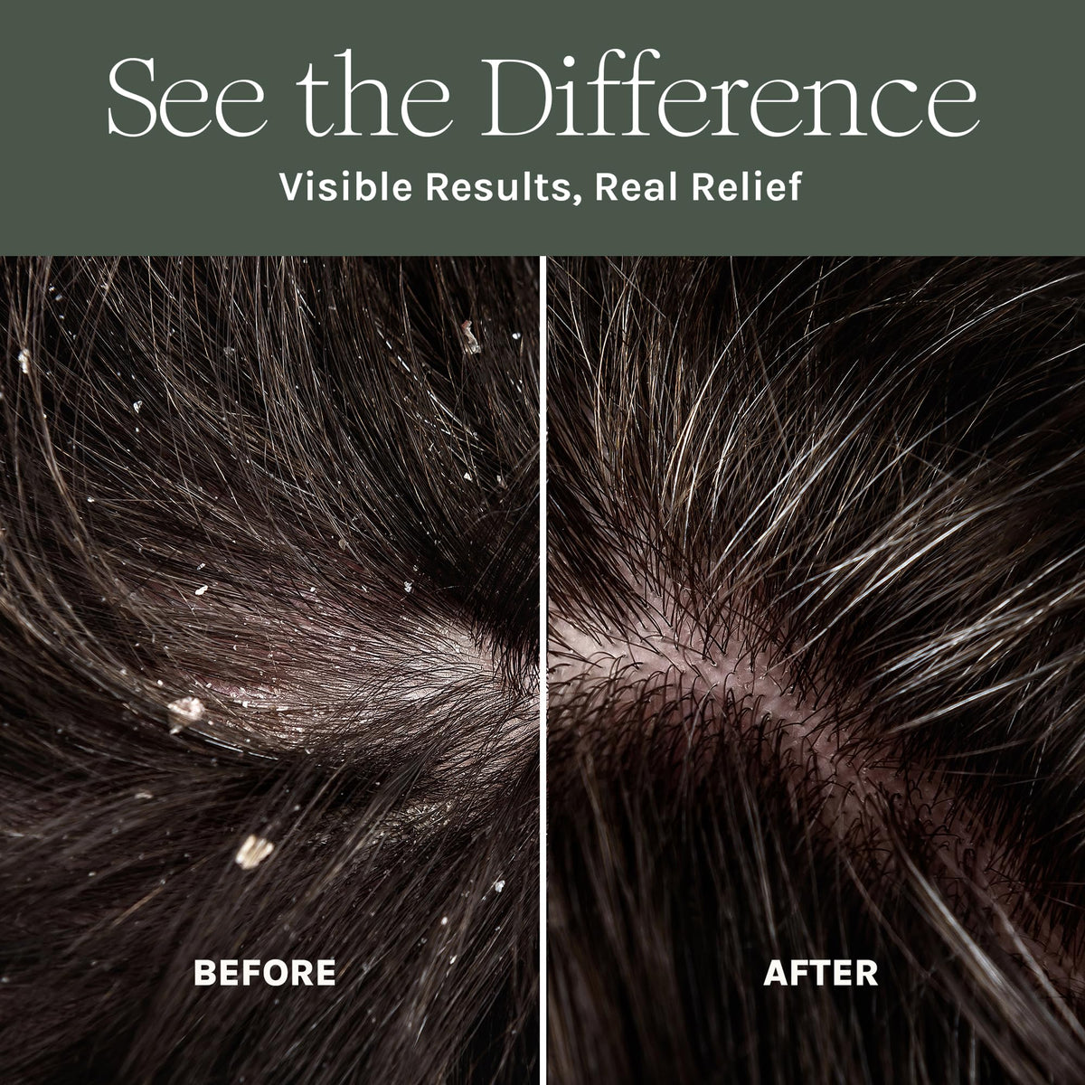 Purist Dandruff Spray ingredients label highlighting aloe, flax oil, and biotin for scalp support.