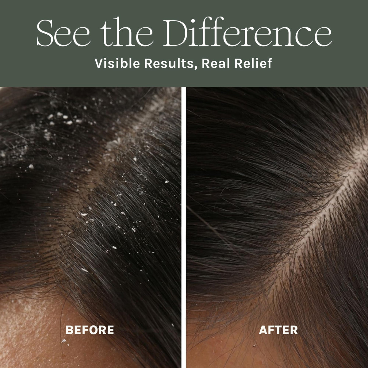 Purist Scalp Mask hydration visual highlighting aloe and calendula soothing the scalp.