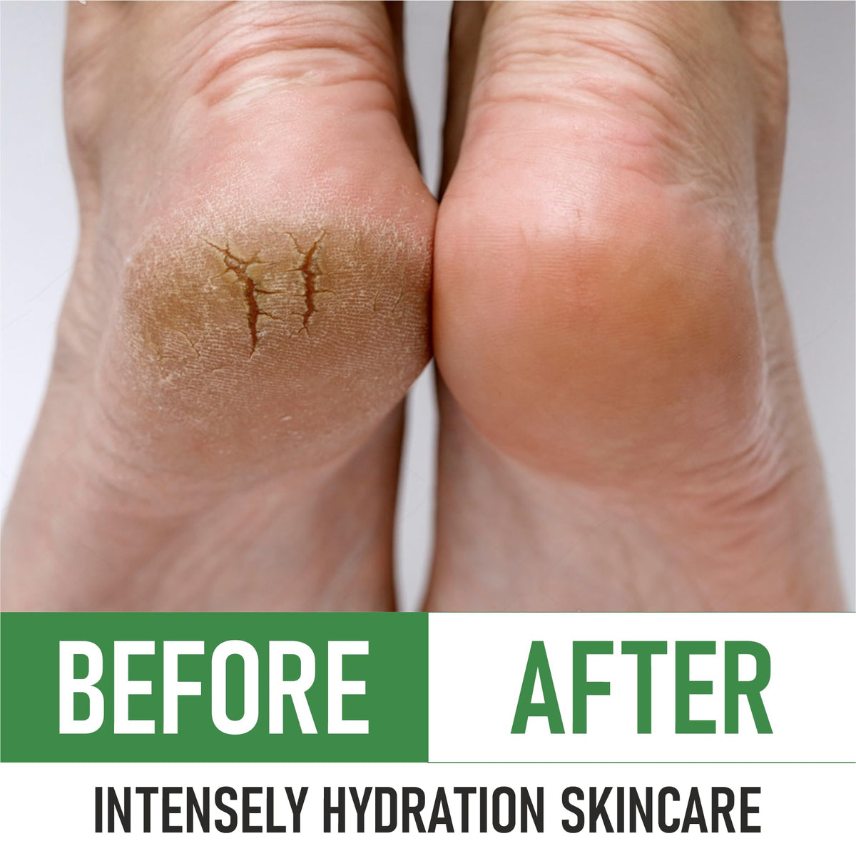 Dry skin before-and-after vibe with smooth skin.