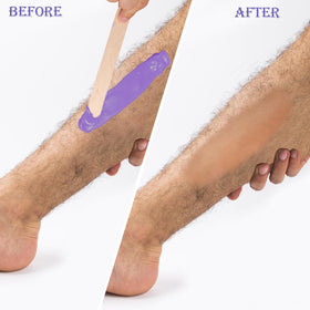 Leg waxing with PURPLESKY beads for smooth, lasting results