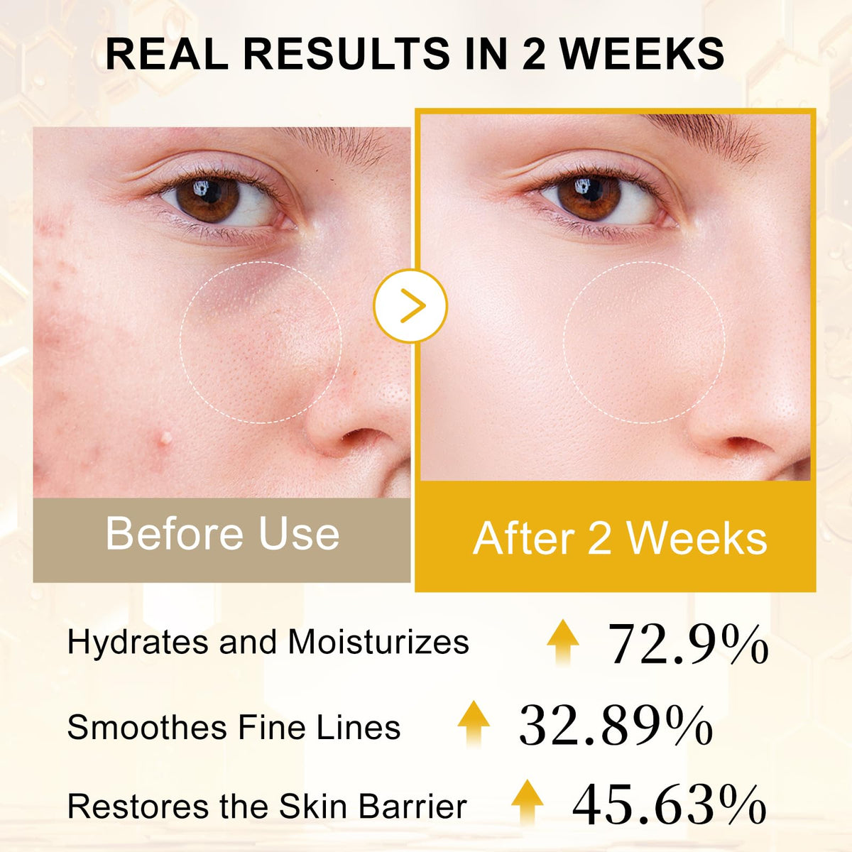 Honey and jojoba oil components in Qgala Serum for deep hydration