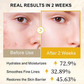 Honey and jojoba oil components in Qgala Serum for deep hydration