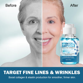 Racgrul microneedling serum ampoules ready for precise application
