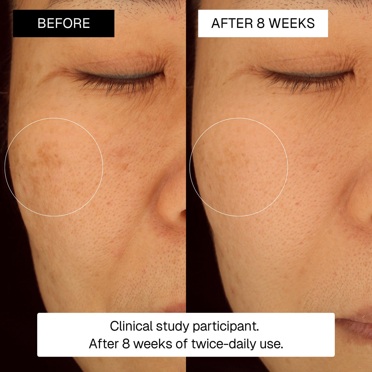 Radiance Plan Dark Spot Serum smooths texture and evens tone.