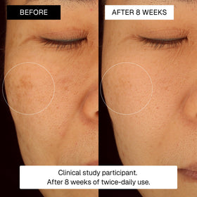 Radiance Plan Dark Spot Serum smooths texture and evens tone.
