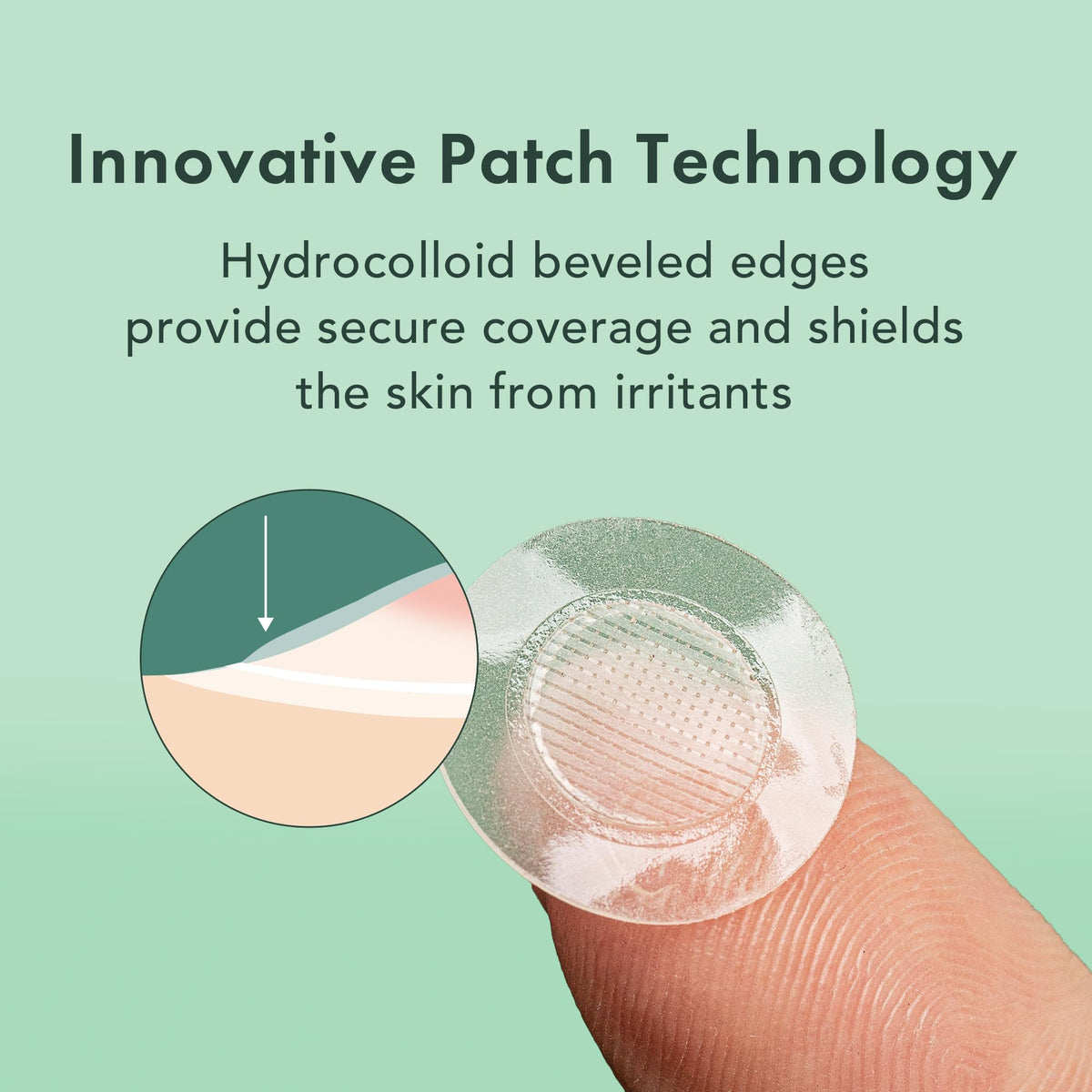 Hydrocolloid adhesive patch from Rael sticks firmly to affected skin.