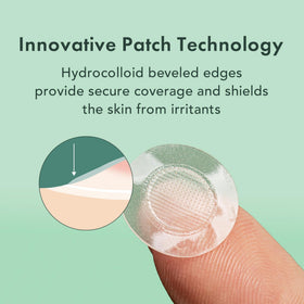 Hydrocolloid adhesive patch from Rael sticks firmly to affected skin.