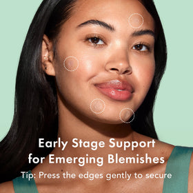 Rael Pimple Patches infused with succinic acid for gentle care.