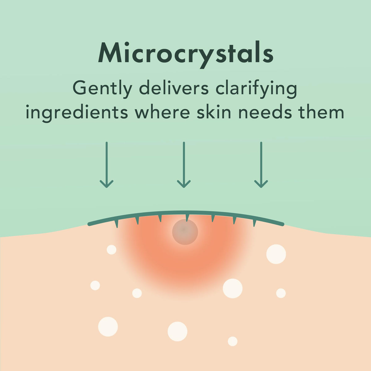 Rael Pimple Patches with willow bark extract supporting blemish refinement.