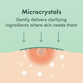 Rael Pimple Patches with willow bark extract supporting blemish refinement.