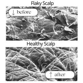 RAUSCH Coltsfoot Anti-Dandruff Shampoo foam close-up demonstrates rich lather.