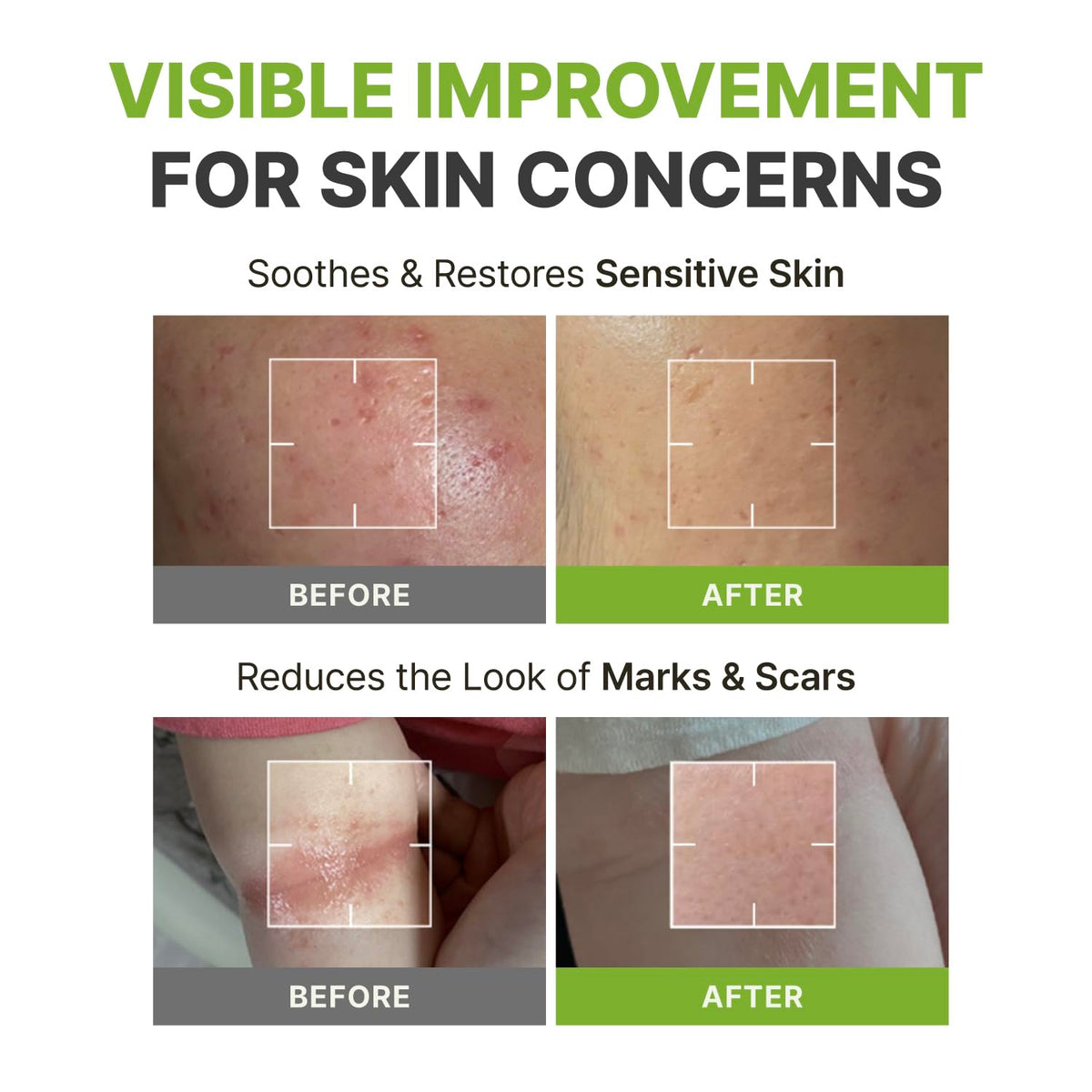 Rbfy Ampoule-soaked pad closeup highlighting deep hydration and soothing feel