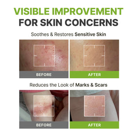 Rbfy relief-care pad and bottle highlighting concentrated calming care for sensitive skin.