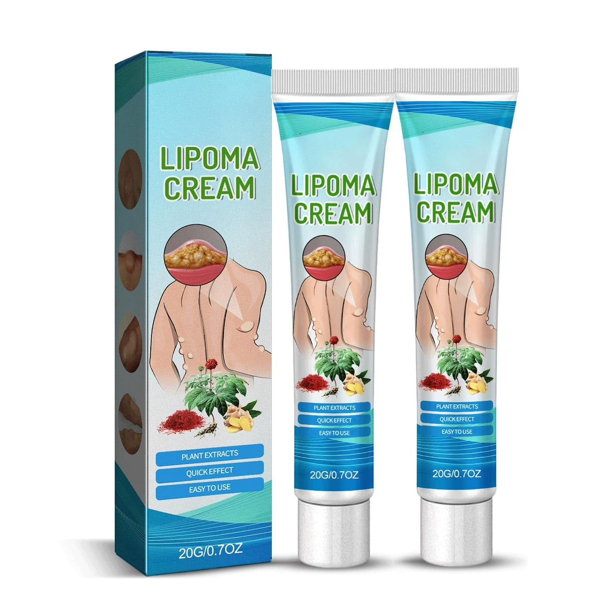 RCSCBC Lipoma Cream bottle for daily moisturizing and sensitive skin care