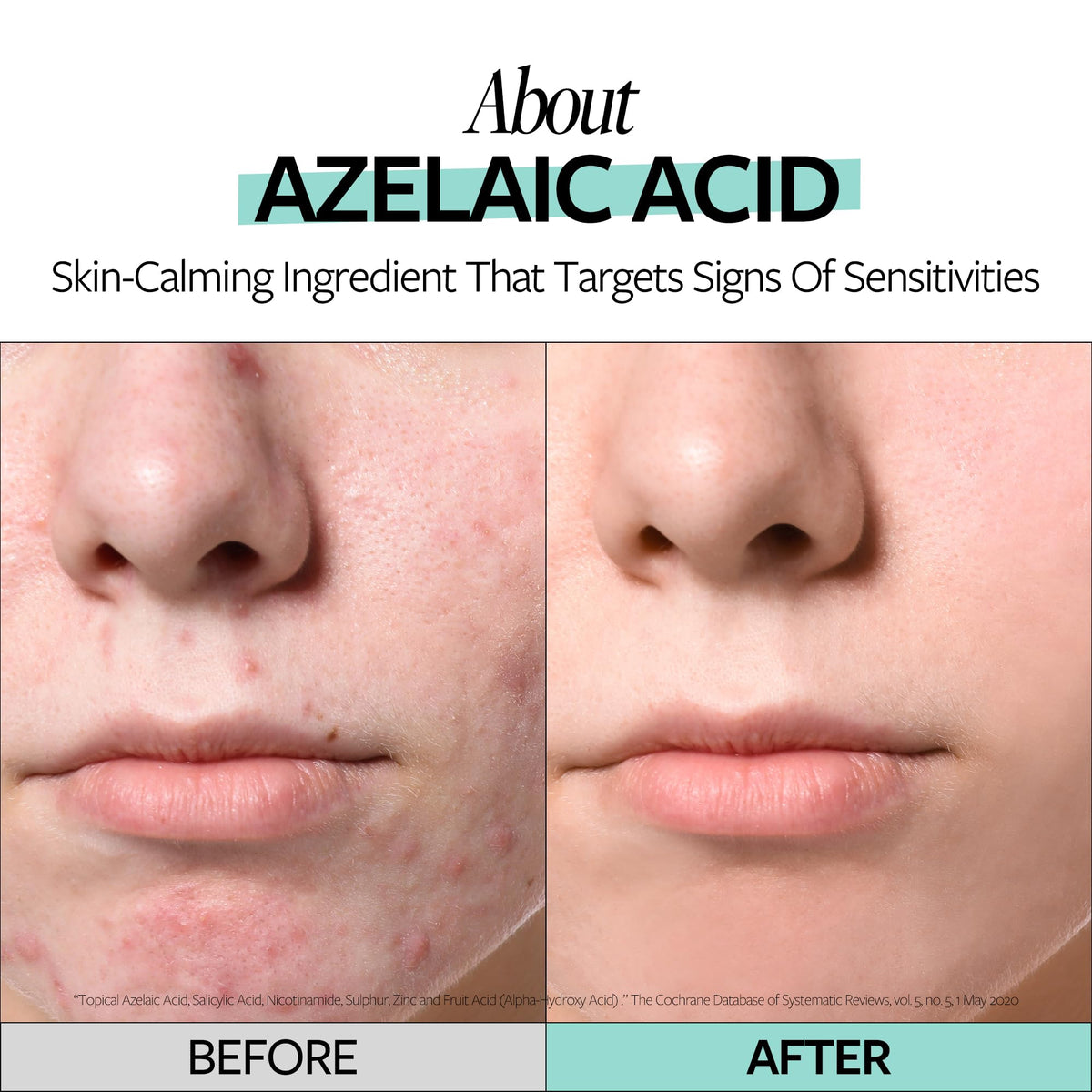 RE:CIPE Azelaic Acid 10 texture swatch highlights lightweight feel