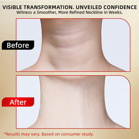 Redcool Retinol Neck Cream highlighting elasticity boost and contour support