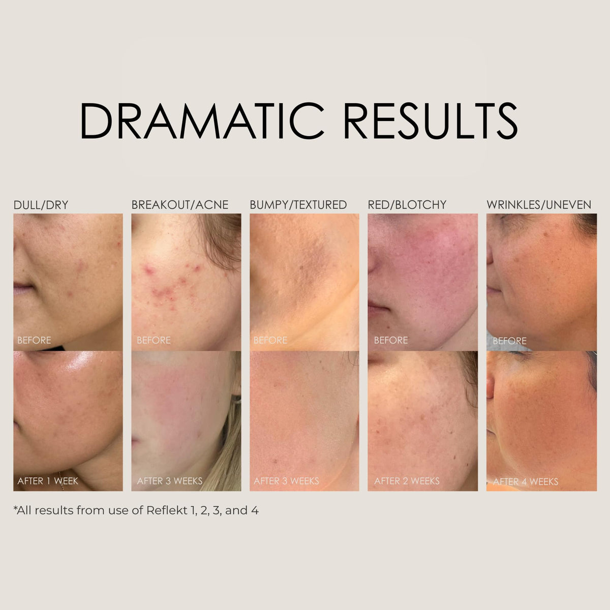 REFLEKT 1 vegetable collagen supports moisture and elasticity.