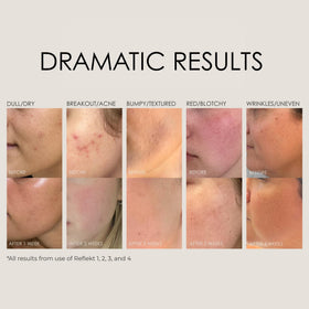 REFLEKT 1 vegetable collagen supports moisture and elasticity.