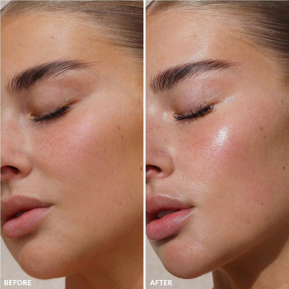 REFY Roller applicator closeup shows soothing massage to reduce puffiness