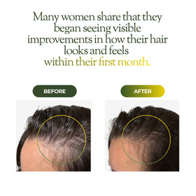 Regener8 application massage on scalp for soothing, quick-absorbing care.