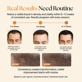 ReGlow bio-active serum bottle highlighting peptides for nourishing follicles.