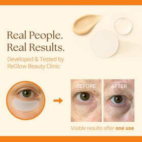 ReGlow Restore microneedle patches application demonstrates precise delivery for smoother under-eyes.