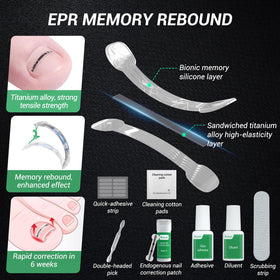 Reieset long-lasting nail-correction effect supports gradual improvement over weeks