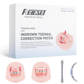 Reieset titanium alloy patch curves the nail for gradual realignment