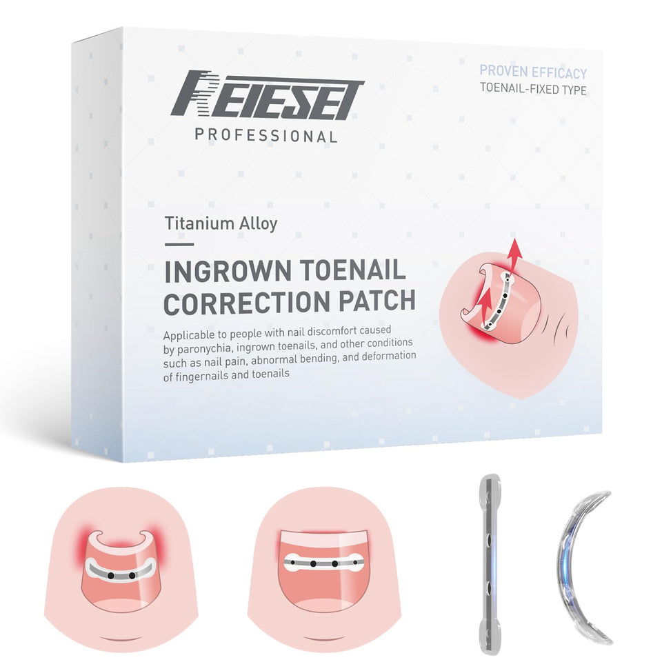 Reieset titanium alloy patch curves the nail for gradual realignment