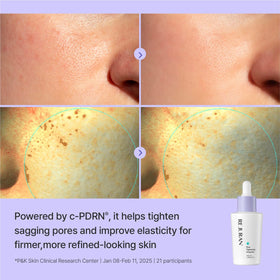 REJURAN Acid Complex visual suggests texture smoothing benefits.