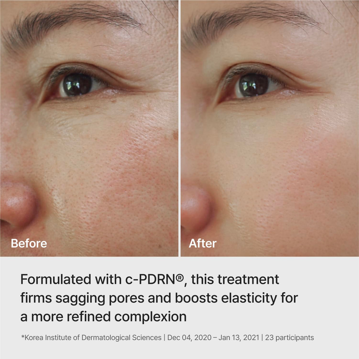 REJURAN Ampoule-Infused Lifting Mask Waterfalling Complex nourishes moisture