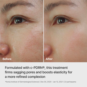 REJURAN Ampoule-Infused Lifting Mask Waterfalling Complex nourishes moisture