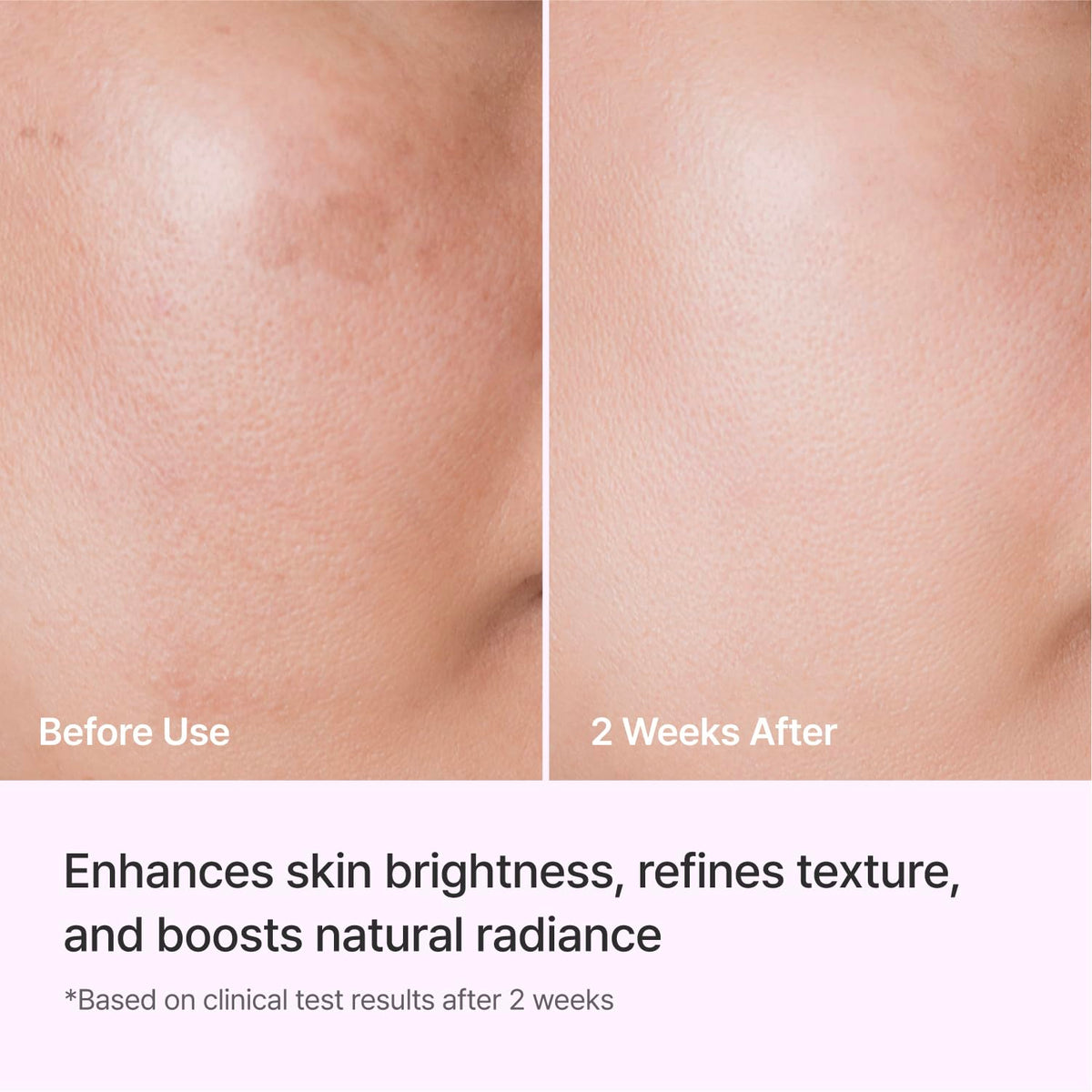REJURAN DOT c-PDRN 0.5% technology visual suggesting advanced skin support.