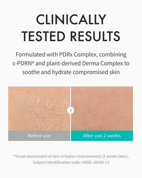 REJURAN Moisture Cream on hand application demonstrates lightweight, daily hydration