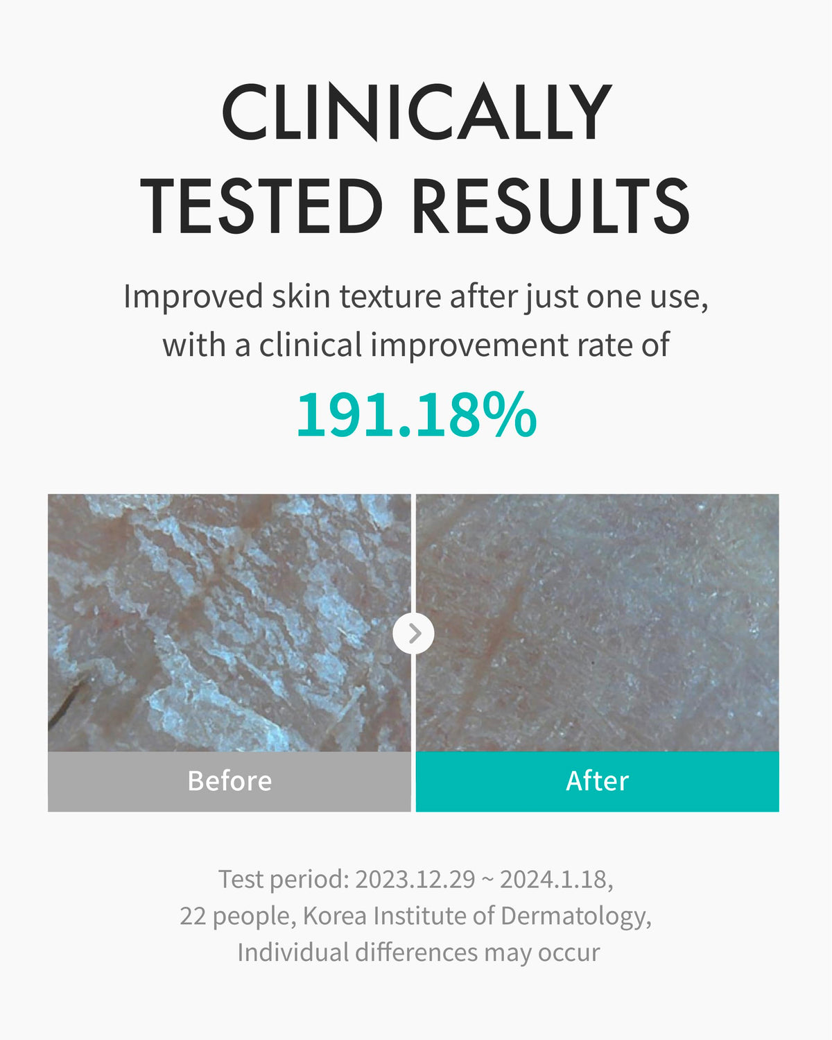 REJURAN Moisture Toner ceramide-rich formula promotes skin barrier health.