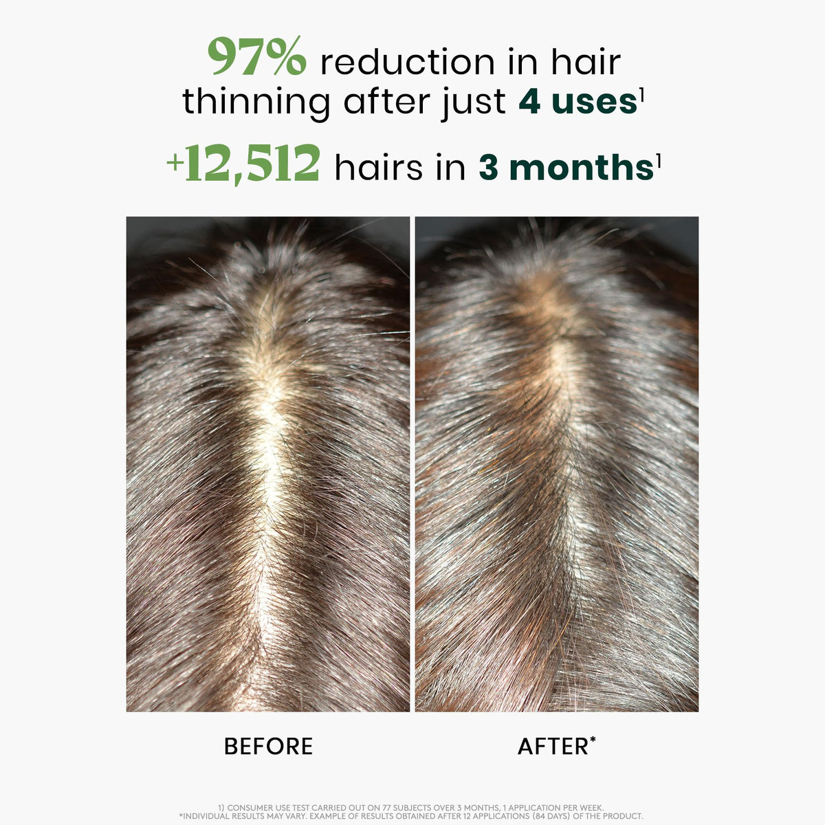 Rene Furterer Triphasic Serum dispensed on clean hand