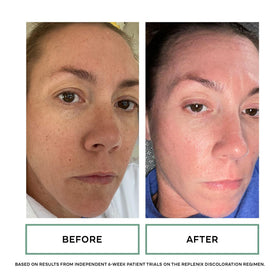 Replenix Glycolic Acid 10% pads beside serum; visualizes routine pairing.