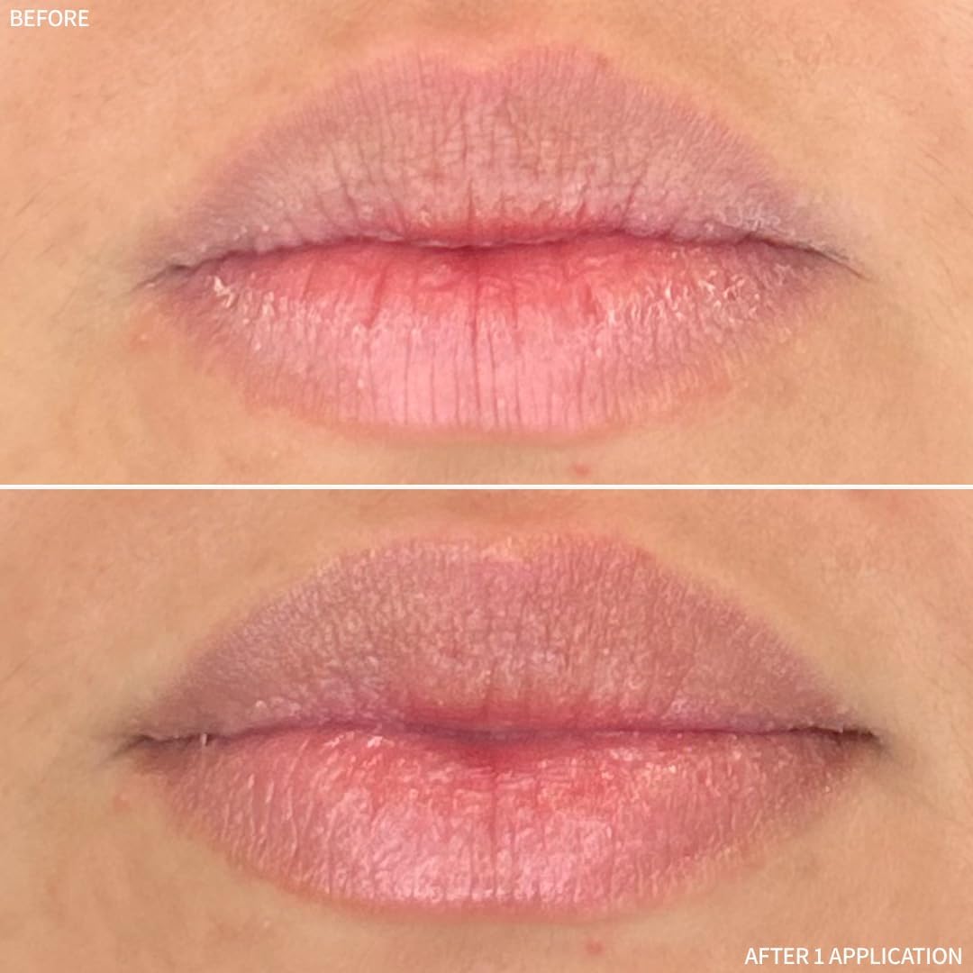 RescueMD Restorative Lip Treatment closeup shows creamy texture ready to apply.