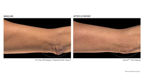 Revision Skincare BodiContour packaging box communicates premium body contouring solution.