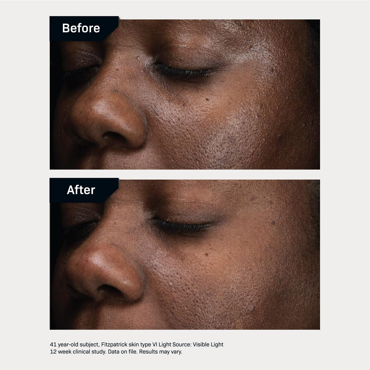 Revision Skincare D·E·J Daily Boosting Serum shown being tapped into skin for refreshing feel.