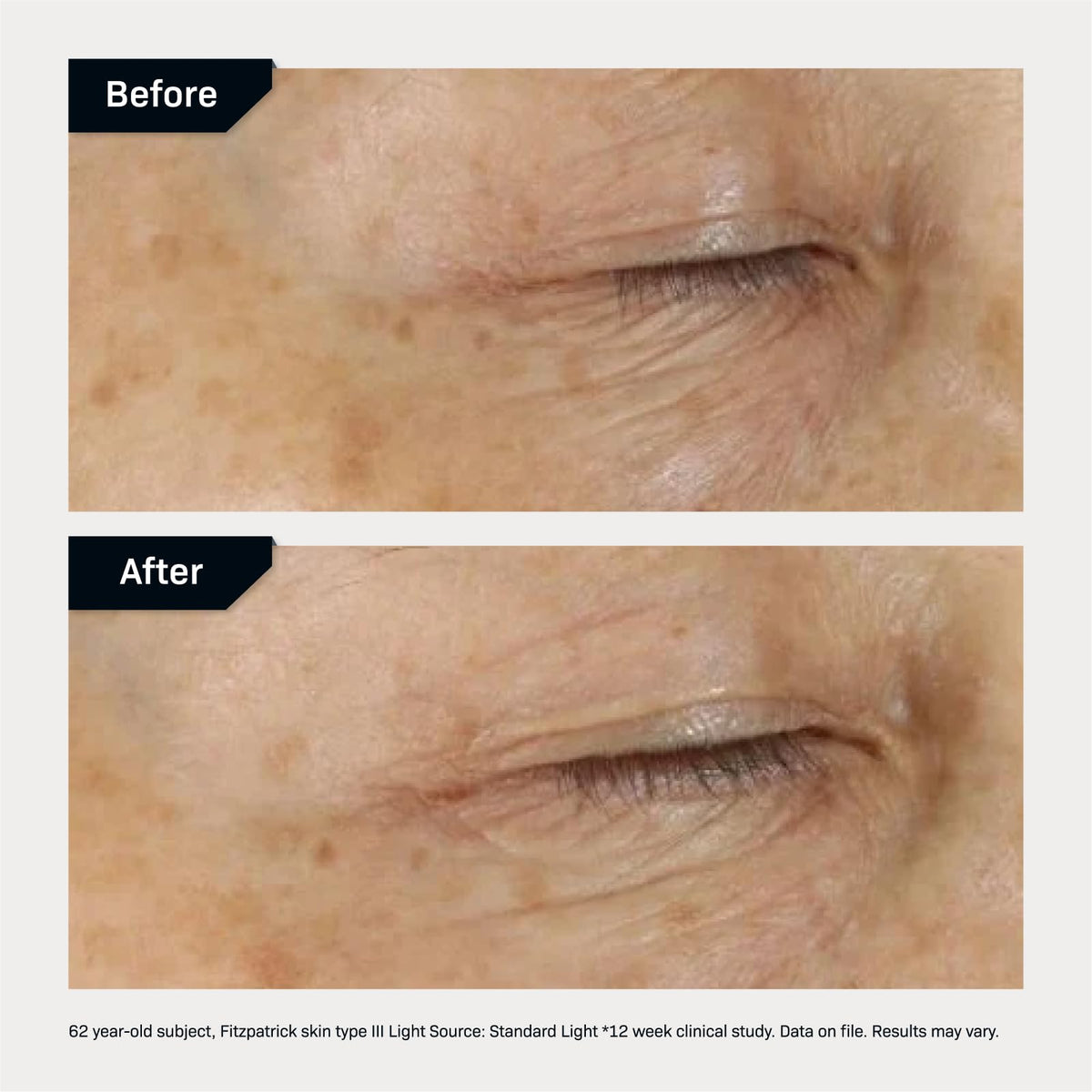 Revision Skincare D·E·J Eye Cream packaging shows premium design and benefits